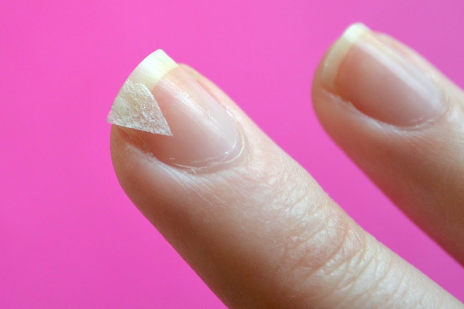 Трещины на ногтях: причины, виды и лечение | Блог маникюрного салона в Москве