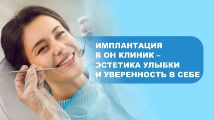 Имплантация зубов в ОН КЛИНИК – эстетика улыбки и уверенность в себе