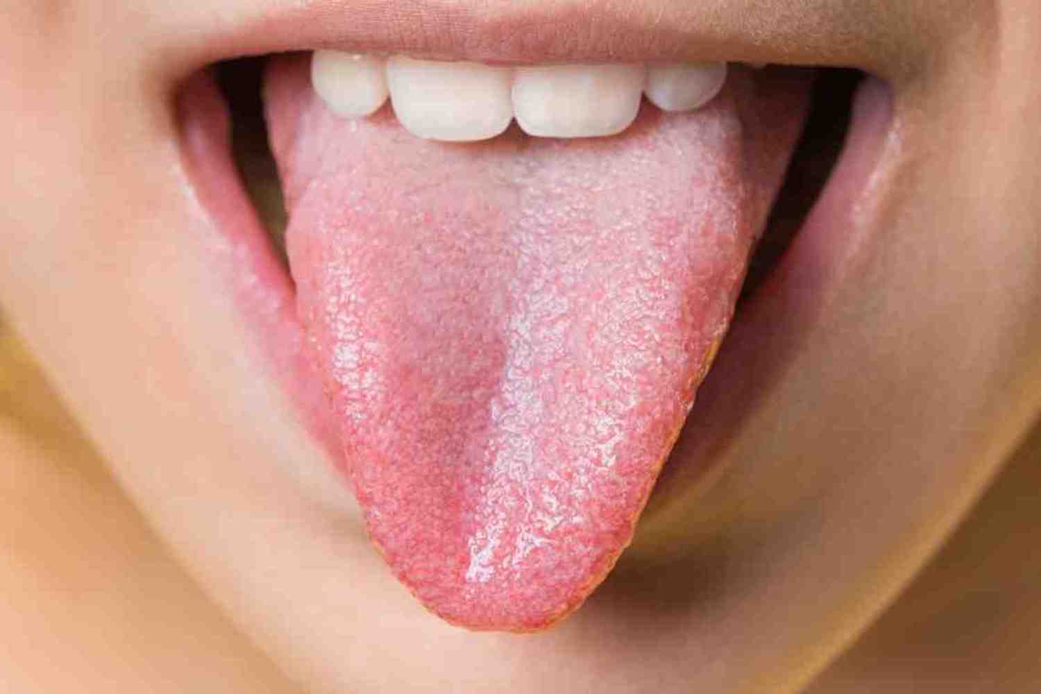 Налет на языке у ребенка – стоит ли беспокоиться?